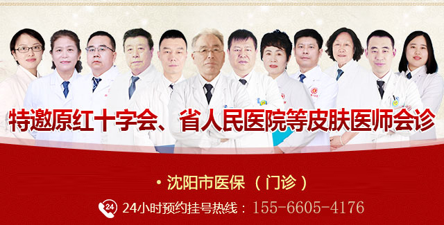 沈阳白癜风专科医院